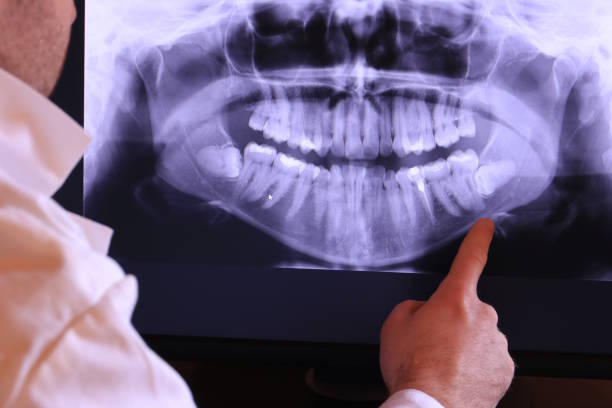 Best Knocked-Out Tooth Emergency  in Duluth, WA